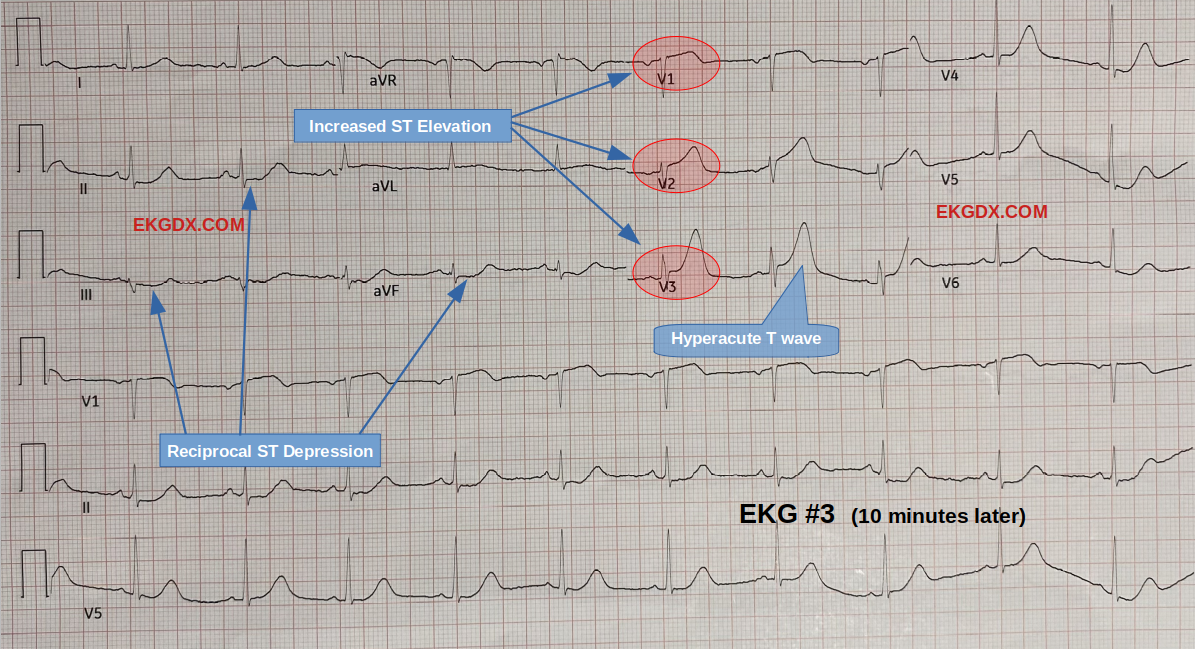 EKGDX - The new era of EKG learning
